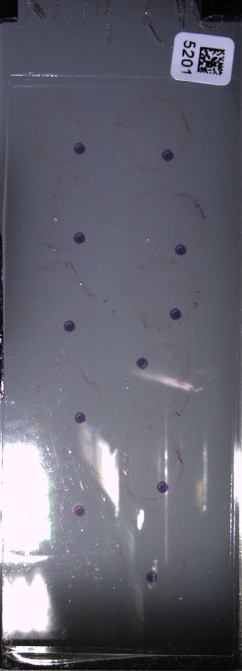 Media type: image; Special Collections 4011   shows specimen_part histological serial section;